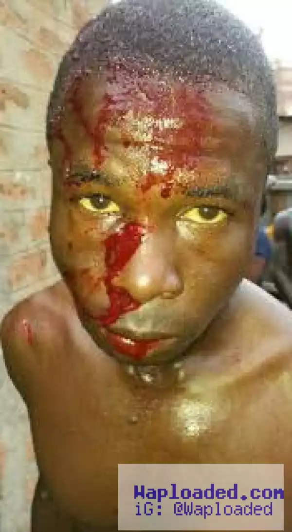 Photo: Okada man stabbed in the head by hoodlums